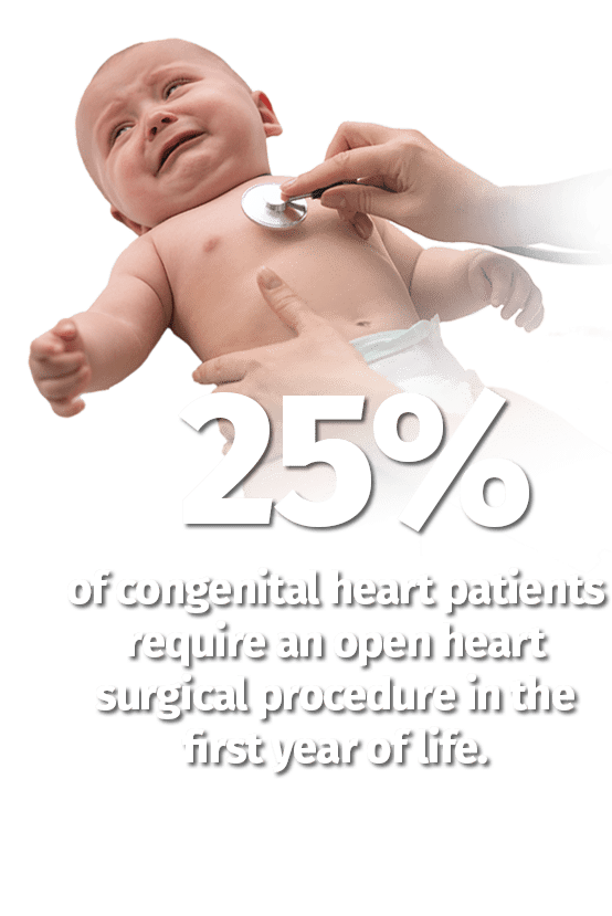 25% of congenital heart patients require an open heart surgical procedure in the first year of life