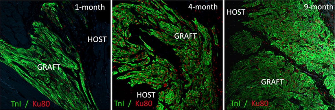 Impanted cells tripled the size