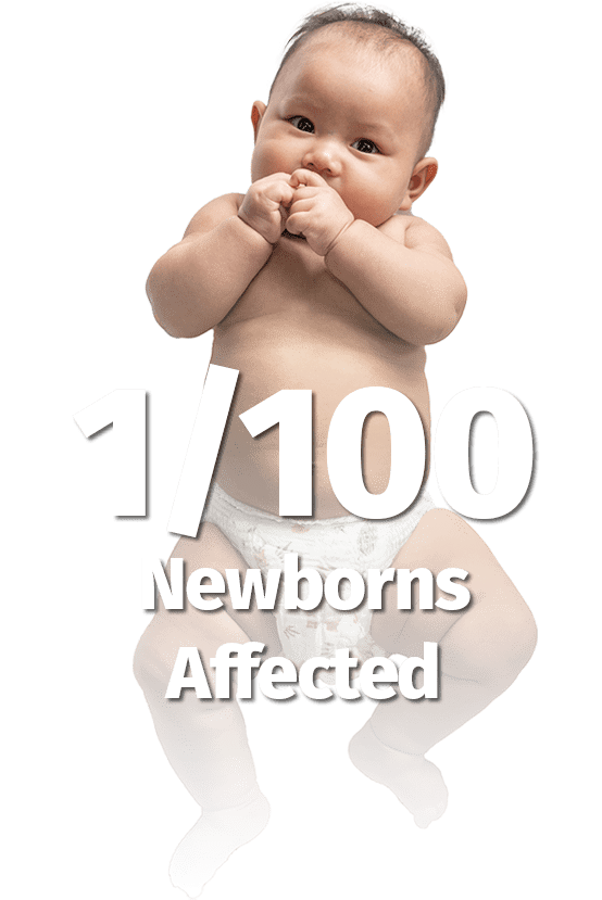 1/100 Newborns Affected